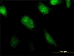 MGC20410 Antibody (1B11), Novus Biologicals 0.1 mg; Unconjugated:Antibodies,
