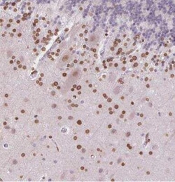 MGC4618 Antibody, Novus Biologicals:Antibodies:Primary Antibodies