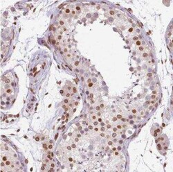 MGC4618 Antibody, Novus Biologicals:Antibodies:Primary Antibodies