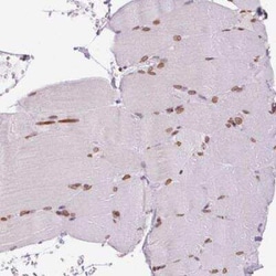 MGC4618 Antibody, Novus Biologicals:Antibodies:Primary Antibodies
