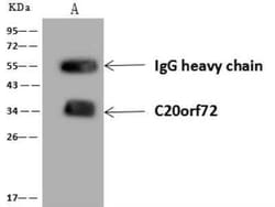 MGME1 Antibody, Novus Biologicals 100 &mu;g; Unconjugated:Antibodies, Polyclonal