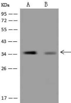 MGME1 Antibody, Novus Biologicals 100 &mu;g; Unconjugated:Antibodies, Polyclonal