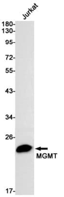 MGMT Antibody (S01-8B1), Novus Biologicals:Antibodies:Primary Antibodies