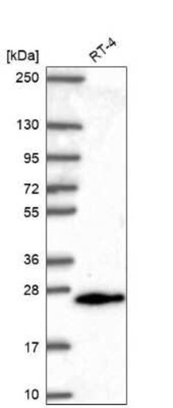 MGMT Antibody, Novus Biologicals 100 &mu;g; Unconjugated:Antibodies, Polyclonal