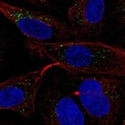 MGRN1 Rabbit anti-Human, Polyclonal, Novus Biologicals 25 &mu;g; Unconjugated:Antibodies,