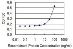 MGST2 Antibody (4E1), Novus Biologicals 0.1 mg, Unconjugated:Antibodies,