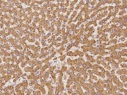 MGST2 Antibody, Novus Biologicals 100 &mu;g, Unconjugated:Antibodies, Polyclonal