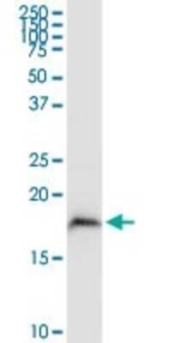 MGST3 Antibody, Novus Biologicals 0.1 mg | Buy Online | Novus Biologicals | Fisher Scientific