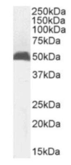 MHC Class I Antibody (R1-21.2) - Chimeric - Azide and BSA Free, Novus Biologicals:Antibodies:Primary