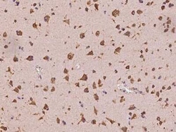 MIA3 Antibody, Novus Biologicals 50 &mu;g, Unconjugated:Antibodies, Polyclonal