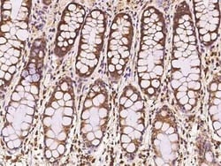 MIA3 Antibody, Novus Biologicals 50 &mu;g, Unconjugated:Antibodies, Polyclonal