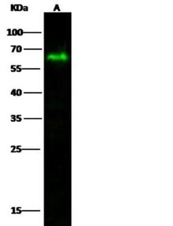 MICB Rabbit anti-Human, Clone: 102, Novus Biologicals 100 &mu;g; Unconjugated:Antibodies,