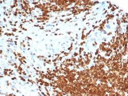 MIS/AMH Antibody (AMH/6713R) - Azide and BSA Free, Novus Biologicals 100 &mu;g | Buy Online | Novus Biologicals | Fisher Scientific