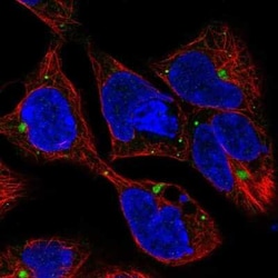 MIS/AMH Antibody, Novus Biologicals:Antibodies:Primary Antibodies