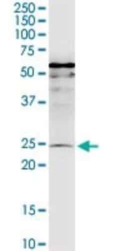 MIS12 Antibody (1G3), Novus Biologicals 0.1 mg; Unconjugated:Anticorps,