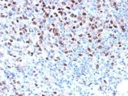 MITF Antibody (MITF/2987R) - Azide and BSA Free, Novus Biologicals 100 &mu;g | Buy Online | Novus Biologicals | Fisher Scientific