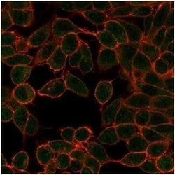 MITF Mouse anti-Human, Clone: PCRP-MITF-1D9, Novus Biologicals:Antibodies:Primary