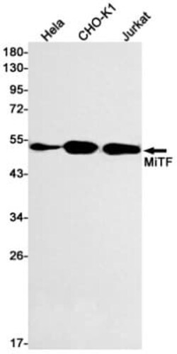 MITF Antibody (S06-4B5), Novus Biologicals:Antibodies:Primary Antibodies