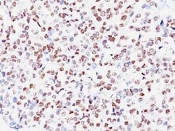 MITF Antibody (SPM290), Novus Biologicals:Antibodies:Primary Antibodies