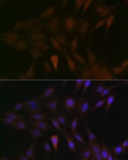 MKK3/MEK3 Rabbit anti-Human, Mouse, Rat, Clone: 8U2X3, Novus Biologicals