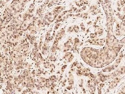 MKK4/MEK4 Antibody, Novus Biologicals 100 &mu;g; Unconjugated:Anticorps,