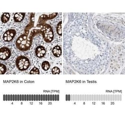 MKK6/MEK6 Antibody, Novus Biologicals:Antibodies:Primary Antibodies