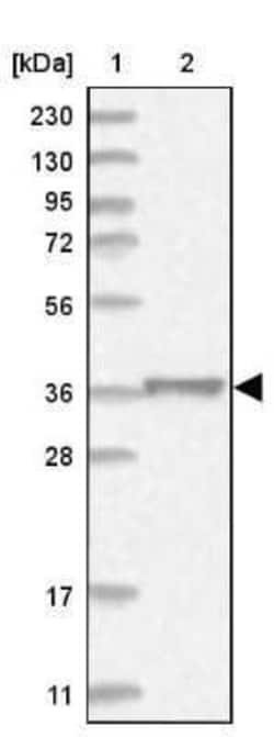 MKK6/MEK6 Antibody, Novus Biologicals:Antibodies:Primary Antibodies