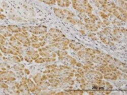 MKK7/MEK7 Antibody (2G5), Novus Biologicals 0.1 mg | Buy Online | Novus Biologicals | Fisher Scientific