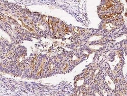 MKKS Antibody, Novus Biologicals 100 &mu;g, Unconjugated:Antibodies, Polyclonal