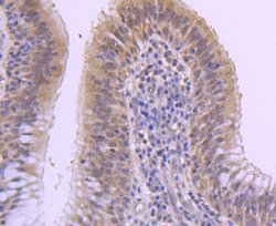 MKP-1/DUSP1 Antibody (JJ0930), Novus Biologicals 100&mu;L:Antibodies, Monoclonal