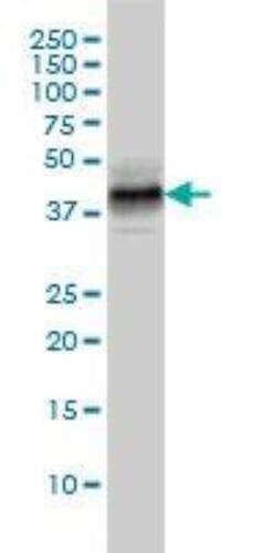 MKP-3/DUSP6 Antibody (3G2), Novus Biologicals 0.1 mg | Buy Online | Novus Biologicals | Fisher Scientific