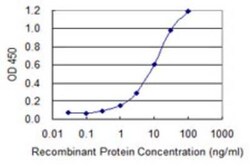 Novus Biologicals MKRN1 Antibody (4E9), Novus Biologicals 0.1 mg | Buy Online | Novus Biologicals&trade; | Fisher Scientific