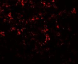 MKRN3 Antibody - BSA Free, Novus Biologicals 0.1 mg; Unconjugated:Antibodies,