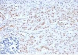 MLH1 Rabbit anti-Human, Clone: MLH1/6284R, Novus Biologicals 20 &mu;g;