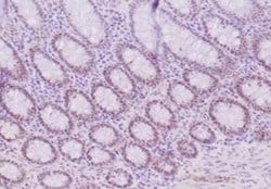 MLH1 Rabbit anti-Human, Clone: MLH1/6284R, Novus Biologicals 20 &mu;g;