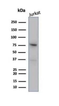 MLH1 Rabbit anti-Human, Clone: MLH1/6284R, Novus Biologicals 20 &mu;g;