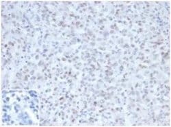 MLH1 Mouse anti-Human, Clone: MLH1/6467, Novus Biologicals 20 &mu;g | Buy Online | Novus Biologicals | Fisher Scientific