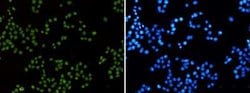 MLH1 Rabbit anti-Human, Clone: S07-5D3, Novus Biologicals:Antibodies:Primary