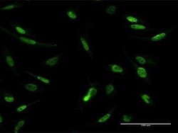 MLLT1 Antibody, Novus Biologicals 0.05 mg | Buy Online | Novus Biologicals | Fisher Scientific