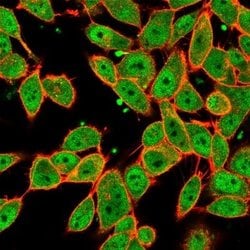 MLX Antibody (PCRP-MLX-1G8) - Azide and BSA Free, Novus Biologicals 100