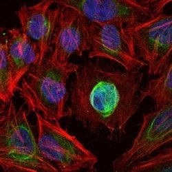 MMP-1 Antibody (6A5) - Azide and BSA Free, Novus Biologicals 0.1 mL; Unconjugated:Antibodies,