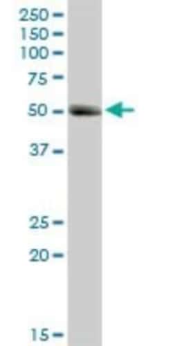 Novus Biologicals MMP-1 Antibody, Novus Biologicals 0.1 mg | Buy Online | Novus Biologicals&trade; | Fisher Scientific