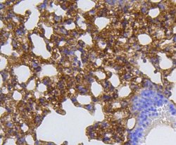 MMP-12 Antibody (SR03-23), Novus Biologicals 100&mu;L:Antibodies, Monoclonal