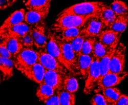 MMP-13 Rabbit anti-Human, Clone: JF0893, Novus Biologicals 100&mu;L:Antibodies,
