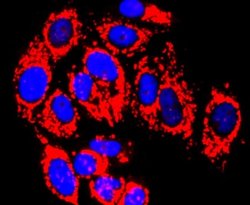 MMP-13 Rabbit anti-Human, Clone: JF0893, Novus Biologicals 100&mu;L:Antibodies,