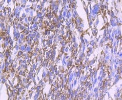 MMP-13 Rabbit anti-Human, Clone: JF0893, Novus Biologicals 100&mu;L:Antibodies,