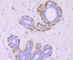 MMP-13 Rabbit anti-Human, Clone: JF0893, Novus Biologicals 100&mu;L:Antibodies,
