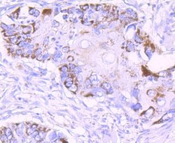 MMP-13 Rabbit anti-Human, Clone: JF0893, Novus Biologicals 100&mu;L:Antibodies,