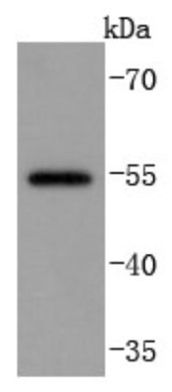 MMP-13 Rabbit anti-Human, Clone: JF0893, Novus Biologicals 100&mu;L:Antibodies,
