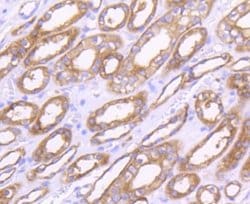 MMP-14/MT1-MMP Antibody (3-F7), Novus Biologicals 100 &mu;L | Buy Online | Novus Biologicals | Fisher Scientific